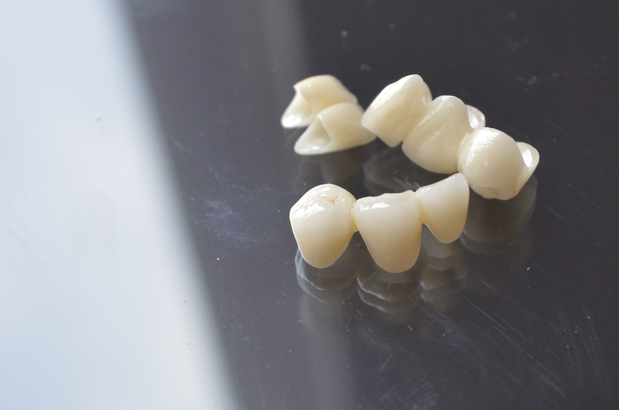 Characteristics and features of layered zirconia crowns